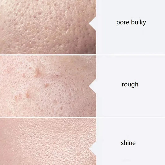 Hydra Aqua Peel Solution Kit – AS1 SA2 AO3 (3 Serums, 400ml)