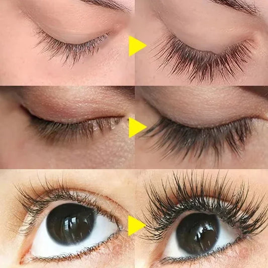 Eyelash Growth Serum – Longer, Fuller & Thicker Lashes