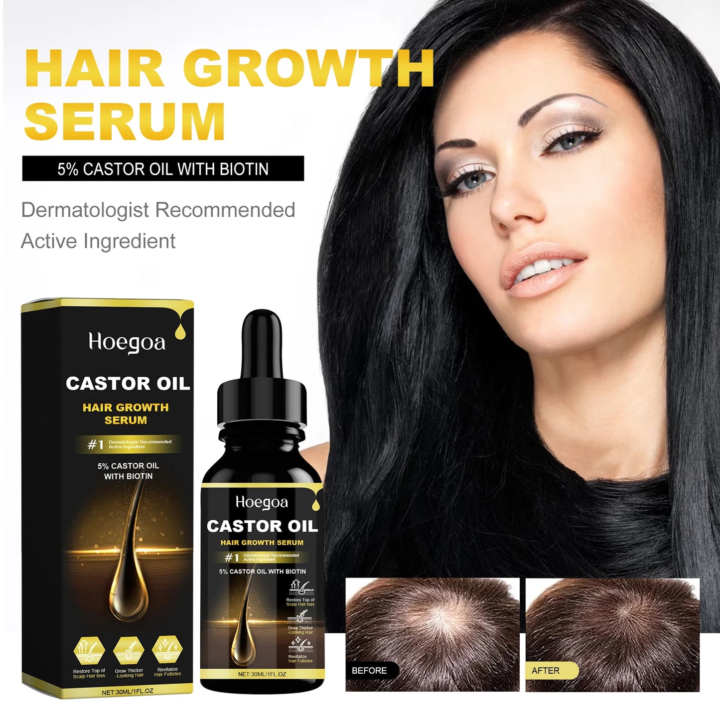 Hoegoa Castor Oil – Nourishing Hair & Scalp Care Oil 30ml