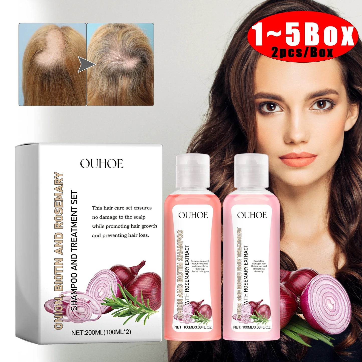 Biotin & Rosemary Shampoo and Conditioner Set – Paraben Free Hair Care