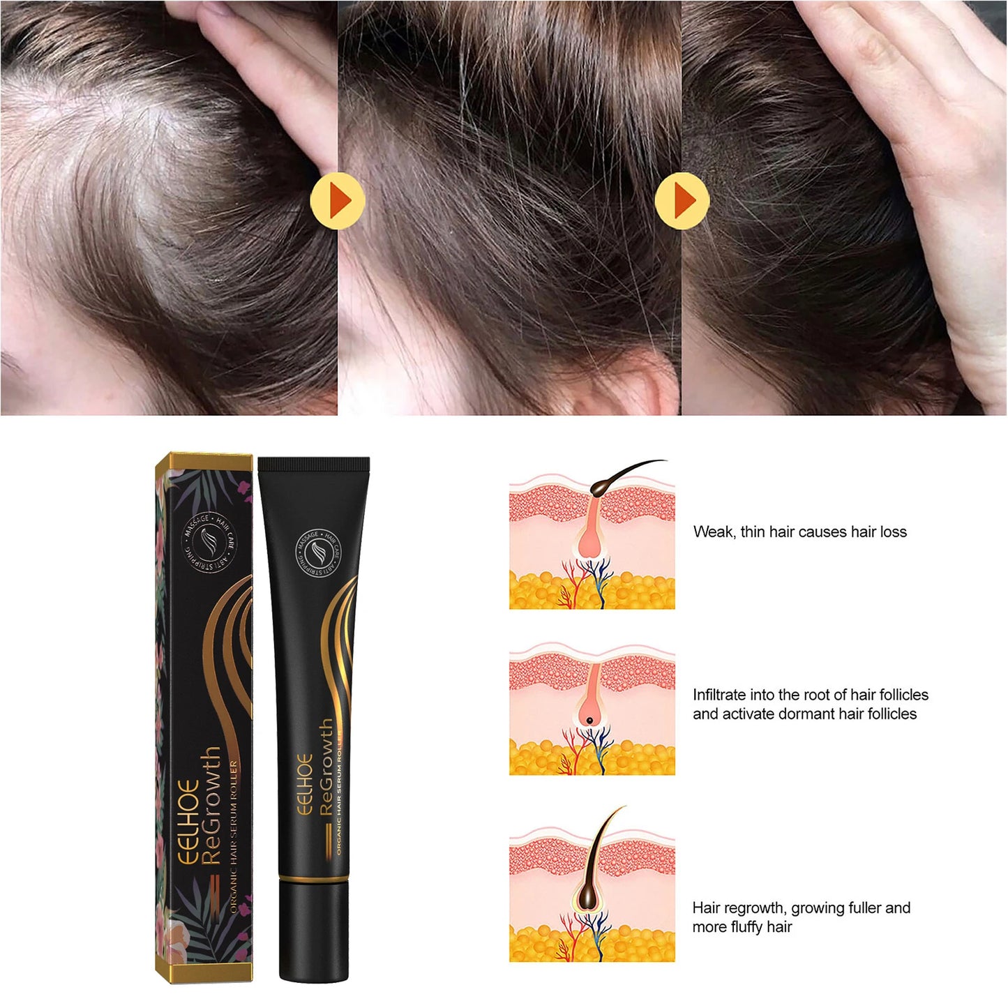 EELHOE Hair Serum with Scalp Massager – Nourishing & Strengthening Hair Care