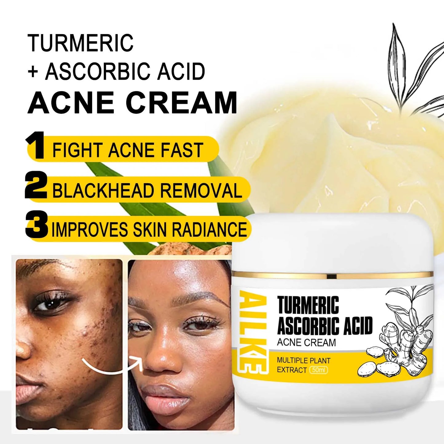Organic Turmeric Kit – Brightening, Spot Removal, Acne Treatment & Hydration Routine