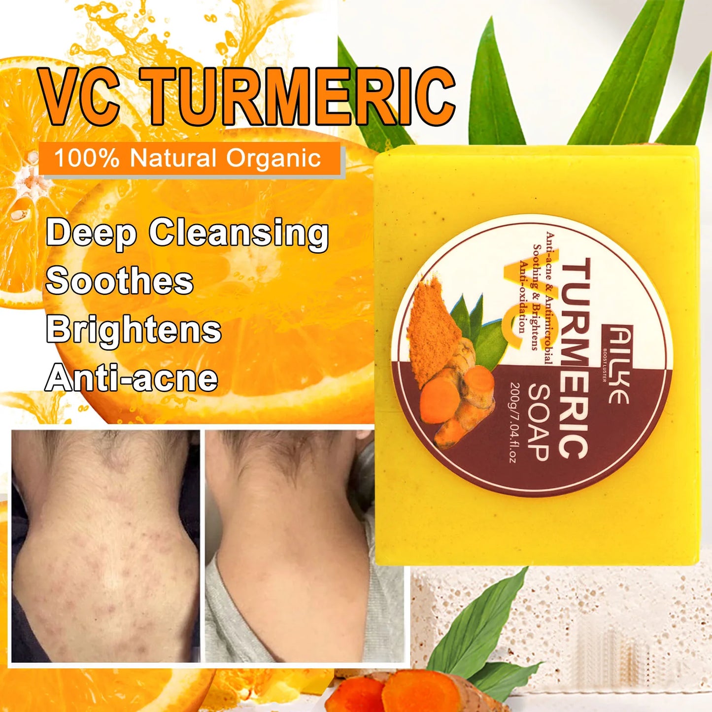 Organic Turmeric Kit – Brightening, Spot Removal, Acne Treatment & Hydration Routine