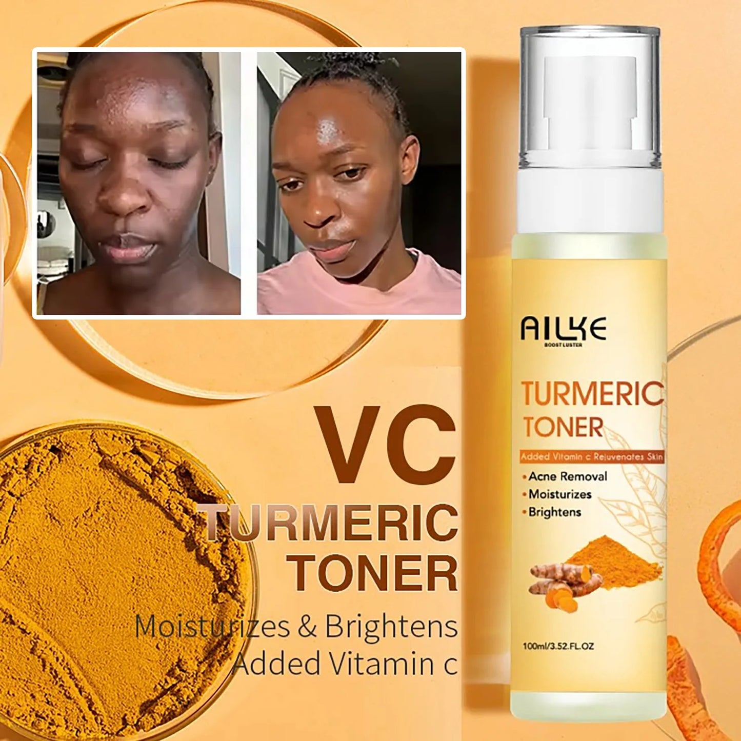 Organic Turmeric Kit – Brightening, Spot Removal, Acne Treatment & Hydration Routine
