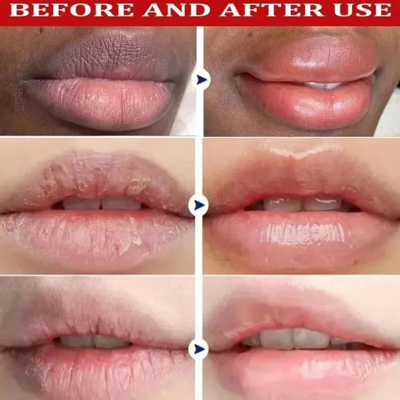 Lip Lightening Balm Serum – Dark Lips Repair & Exfoliating Care