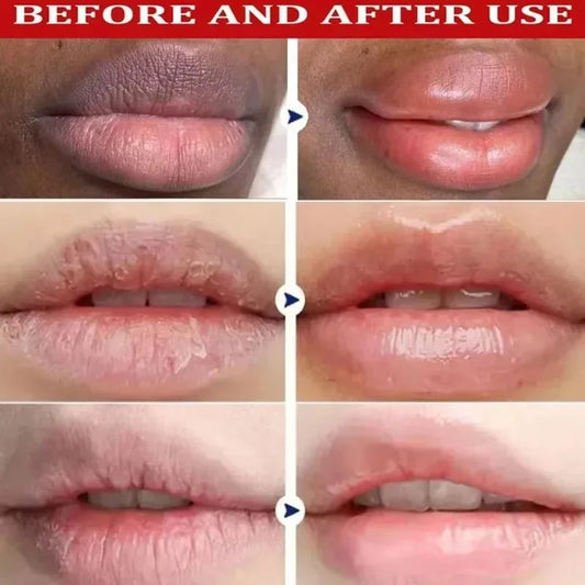 Lip Lightening Balm Serum – Dark Lips Repair & Exfoliating Care