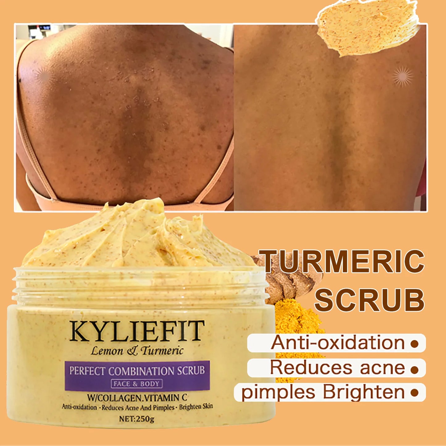 Organic Turmeric Kit – Brightening, Spot Removal, Acne Treatment & Hydration Routine