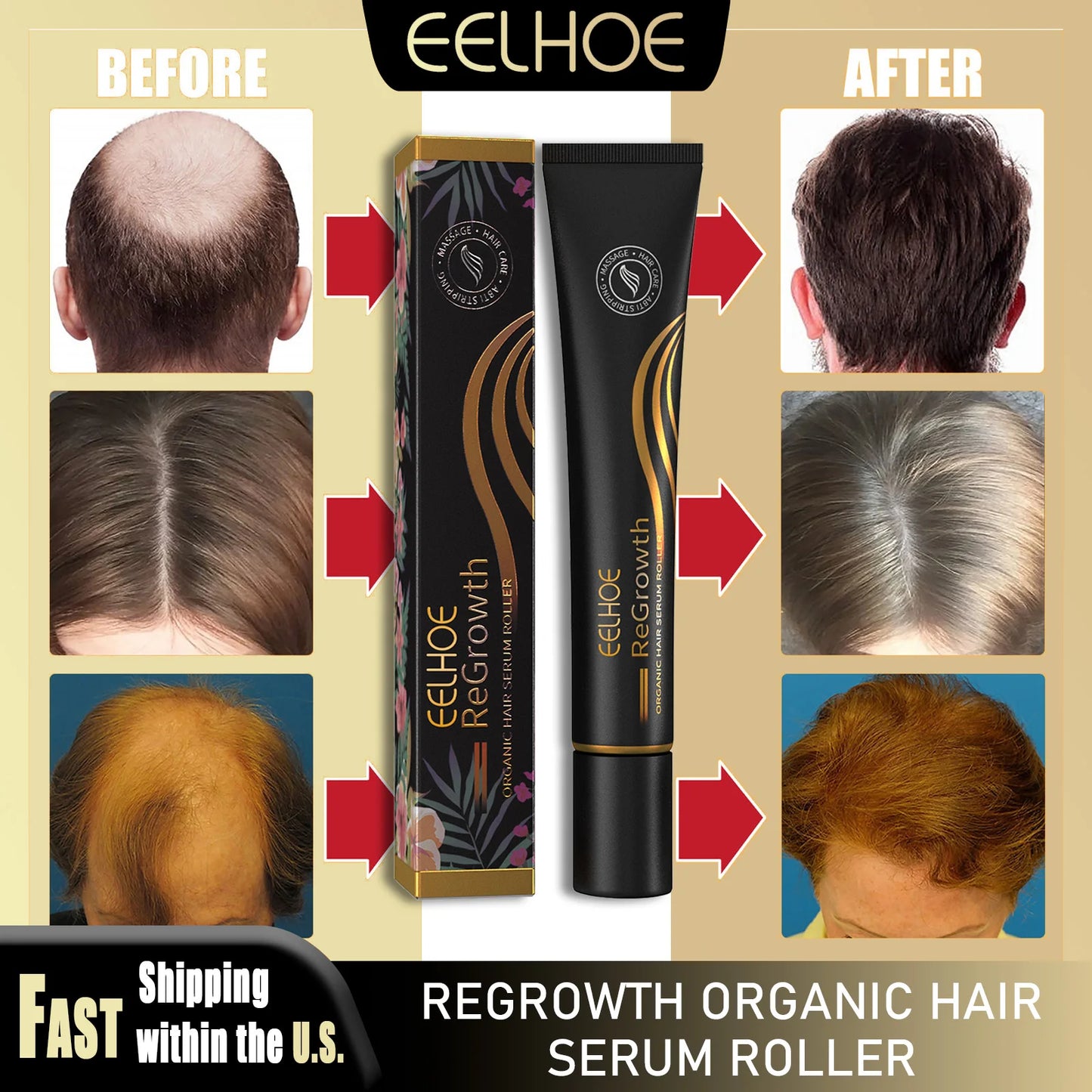 EELHOE Hair Serum with Scalp Massager – Nourishing & Strengthening Hair Care