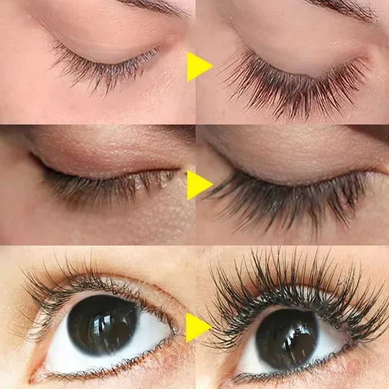 Eyelash Growth Serum – Longer, Fuller & Thicker Lashes