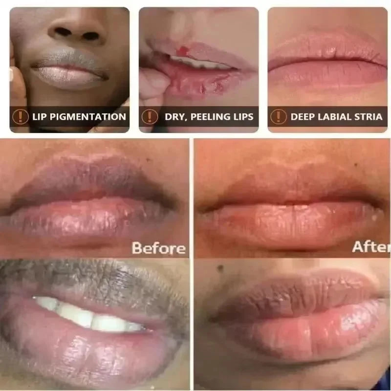 Lip Lightening Balm Serum – Dark Lips Repair & Exfoliating Care