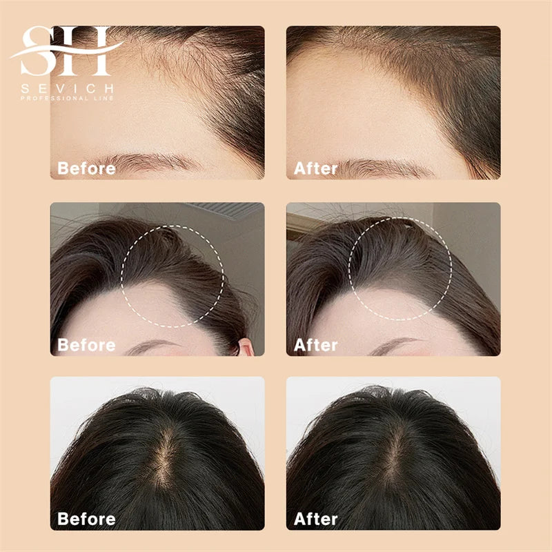 Sevich Hair Shadow Fiber (Hair root concealer)